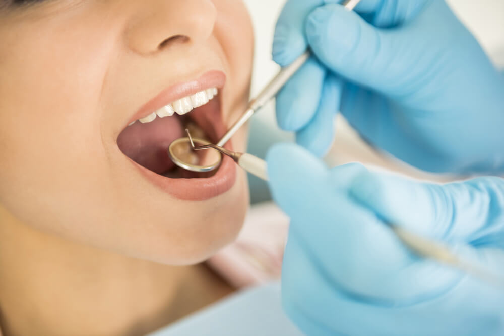 Es importante acudir al dentista antes de una operación.